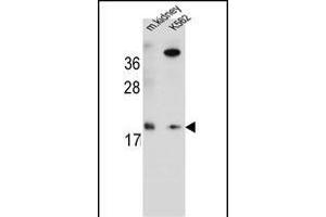 R Antibody (Center) (ABIN654772 and ABIN2844451) western blot analysis in mouse kidney tissue and K562 cell line lysates (35 μg/lane).