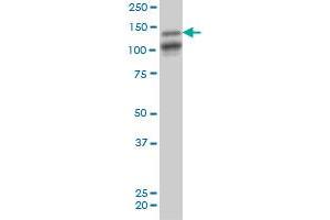 MAGI1 monoclonal antibody (M03), clone 7B4 Western Blot analysis of MAGI1 expression in PC-12 . (MAGI1 Antikörper  (AA 761-859))