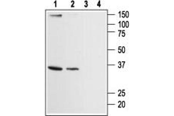 ORAI2 Antikörper  (Intracellular, N-Term)