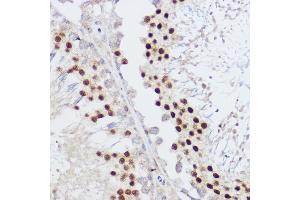 Immunohistochemistry of paraffin-embedded rat testis using KLF12 antibody (ABIN7268152) at dilution of 1:100 (40x lens).