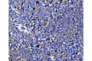 IHC analysis of Il13 using anti-Il13 antibody (ABIN7600672). (IL-13 Antikörper  (AA 22-131))