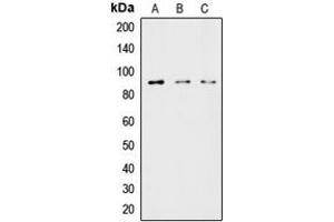 Western blot analysis of HSL expression in HeLa (A), MCF7 (B), COLO205 (C) whole cell lysates. (LIPE Antikörper  (Center))