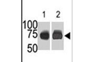 The SPHK2 polyclonal antibody  is used in Western blot (Lane 1) to detect c-myc-tagged SPHK2 in transfected 293 cell lysate (ac-myc antibody is used as control in Lane 2) . (SPHK2 Antikörper  (N-Term))