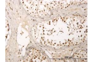 Image no. 1 for anti-Zinc Finger Protein 213 (ZNF213) (AA 133-243) antibody (ABIN599017) (ZNF213 Antikörper  (AA 133-243))