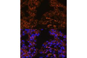 Immunofluorescence analysis of Rat lung cells using Caveolin-1 antibody (ABIN6131271, ABIN6137992, ABIN6137993 and ABIN6218615) at dilution of 1:100.