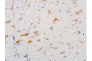 Formalin-fixed and paraffin embedded rat brain labeled with Anti-GGA2 Polyclonal Antibody, Unconjugated  at 1:200 followed by conjugation to the secondary antibody and DAB staining (GGA2 Antikörper  (AA 161-260))