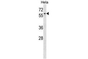 AGFG1 Antibody (N-term) western blot analysis in Hela cell line lysates (35 µg/lane). (AGFG1 Antikörper  (N-Term))