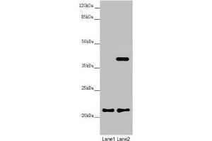 Western blot All lanes: DCTN6 antibody at 3. (DCTN6 Antikörper  (AA 1-190))