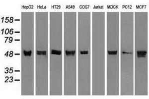 Image no. 3 for anti-Keratin 8 (KRT8) (AA 91-381) antibody (ABIN1491713) (KRT8 Antikörper  (AA 91-381))