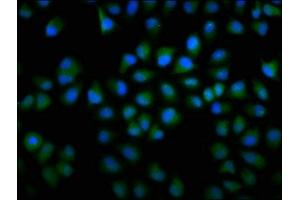 Immunofluorescence staining of Hela cells with ABIN7148001 at 1:166, counter-stained with DAPI. (F13A1 Antikörper  (AA 380-520))