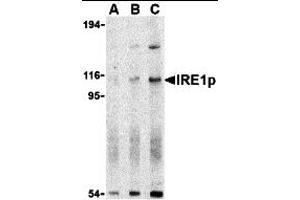 Western Blotting (WB) image for anti-Endoplasmic Reticulum To Nucleus Signaling 1 (ERN1) (N-Term) antibody (ABIN1031419) (ERN1 Antikörper  (N-Term))