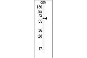 Western blot analysis of anti-CYP2J2 Antibody (Center) in CEM cell line lysates (35ug/lane). (CYP2J2 Antikörper  (Middle Region))