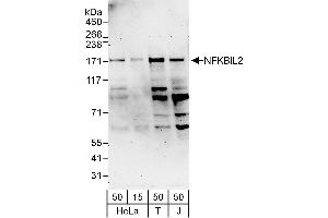 anti-Tonsoku-Like, DNA Repair Protein (NFKBIL2) (AA 425-475) antibody