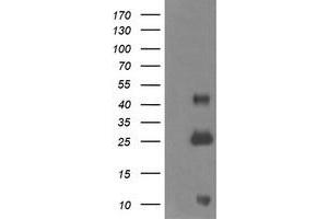 ALDH1A3 Antikörper  (AA 1-100, AA 413-512)