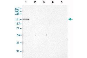 Western Blot analysis of recombinant protein Lane 1: Laminin-332, Lane 2: Laminin-421, Lane 3: Laminin-511, Lane 4: Laminin-121 and Lane 5: Laminin-221 with LAMA3 monoclonal antibody, clone CL3112 .