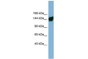 WB Suggested Anti-AASDH Antibody Titration: 0. (AASDH Antikörper  (Middle Region))