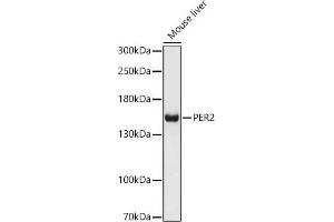 Western blot analysis of extracts of Mouse liver, using PER2 antibody (ABIN6131889, ABIN6145450, ABIN6145452 and ABIN6217063) at 1:1000 dilution. (PER2 Antikörper  (AA 1-150))
