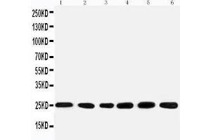Anti-SNRPN antibody, Western blotting Lane 1: Rat kidney Tissue Lysate Lane 2: U87 Cell Lysate Lane 3: U87 Cell Lysate Lane 4: HELA Cell Lysate Lane 5: HMY Cell Lysate Lane 6: NEUR Cell Lysate (SNRPN Antikörper  (N-Term))