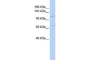 WB Suggested Anti-ZEB1 Antibody Titration:  0. (ZEB1 Antikörper  (N-Term))