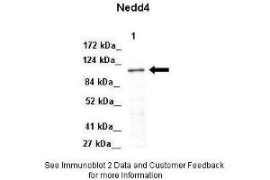 Lanes:   Lane 1: 50ug Mouse adipose lysate  Primary Antibody Dilution:   1:1000  Secondary Antibody:   Donkey anti-Rabbit-HRP  Secondary Antibody Dilution:   1:10000  Gene Name:   NEDD4  Submitted by:   Libin Liu, Boston University. (NEDD4 Antikörper  (Middle Region))