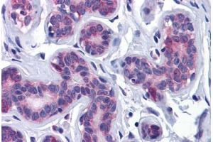 Human Breast: Formalin-Fixed, Paraffin-Embedded (FFPE) (AKT3 Antikörper  (AA 119-136))