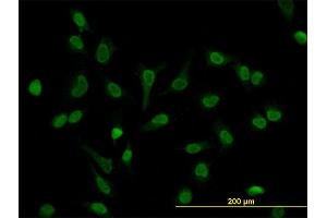 Immunofluorescence of monoclonal antibody to LEF1 on HeLa cell. (LEF1 Antikörper  (AA 14-123))