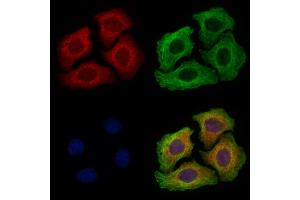 ABIN6256857 and ABIN6273593 staining Hela cells by IF/ICC. (TRIM31 Antikörper  (Internal Region))