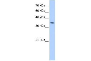WB Suggested Anti-M6PR Antibody Titration:  5. (M6PR Antikörper  (N-Term))
