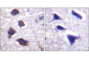 Immunohistochemistry (IHC) image for anti-Adrenergic, beta-2-, Receptor, Surface (ADRB2) (AA 321-370) antibody (ABIN2888906) (beta 2 Adrenergic Receptor Antikörper  (AA 321-370))
