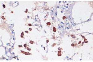 Immunohistochemistry of paraffin-embedded Human lung using CD68 Polyclonal Antibody at dilution of 1:100 (40x lens). (CD68 Antikörper)