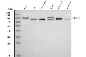 Western blot analysis of MCM8 using anti-MCM8 antibody (ABIN7602113).