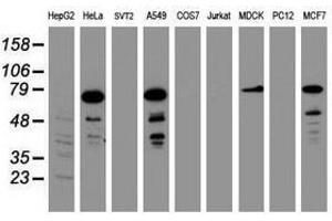 Image no. 2 for anti-Receptor (TNFRSF)-Interacting serine-threonine Kinase 1 (RIPK1) (AA 133-422) antibody (ABIN1490911) (RIPK1 Antikörper  (AA 133-422))