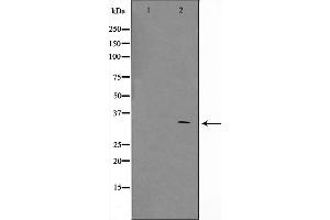 Western blot analysis on COS7 cell lysate using ZNF498 Antibody,The lane on the left is treated with the antigen-specific peptide.