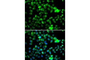 Immunofluorescence analysis of A549 cell using NAA20 antibody. (NAT5 Antikörper)