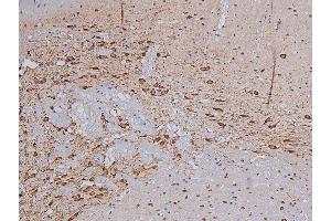 Immunohistochemistry (IHC) image for anti-Tyrosine Hydroxylase (TH) (pSer31) antibody (ABIN6255191)