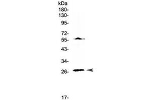 Western blot testing of human Jurkat cell lysate with IL17A antibody at 0. (Interleukin 17a Antikörper)