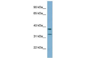 WB Suggested Anti-RALGPS2 Antibody Titration: 0.