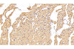 Detection of IL6 in Rat Cardiac Muscle Tissue using Polyclonal Antibody to Interleukin 6 (IL6) (IL-6 Antikörper  (AA 21-211))