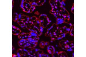 Immunofluorescence of paraffin embedded human placenta using Neil1 (ABIN7073820) at dilution of 1: 300 (400x lens) (NEIL1 Antikörper)
