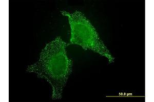 Immunofluorescence of monoclonal antibody to CIB1 on HeLa cell. (CIB1 Antikörper  (AA 1-191))