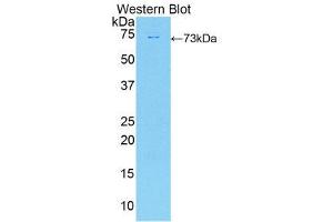 Western Blotting (WB) image for anti-Deiodinase, Iodothyronine, Type II (DIO2) (AA 30-259) antibody (ABIN1858637) (DIO2 Antikörper  (AA 30-259))