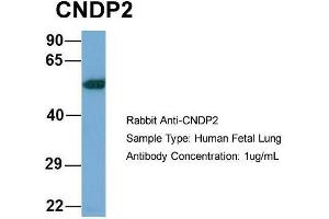 Host: Rabbit  Target Name: CNDP2  Sample Tissue: Human Fetal Lung  Antibody Dilution: 1.