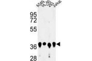 Western Blotting (WB) image for anti-Arginine and Glutamate Rich 1 (ARGLU1) antibody (ABIN3004117) (ARGLU1 Antikörper)