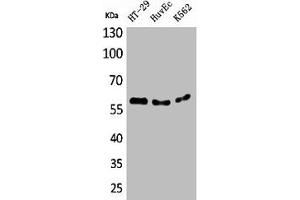 Western Blot analysis of HT29 HuvEc K562 cells using CYP11B1/2 Polyclonal Antibody (CYP11B1 Antikörper  (N-Term))