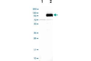 Western blot analysis of Lane 1: Negative control (vector only transfected HEK293T lysate), Lane 2: Over-expression Lysate (Co-expressed with a C-terminal myc-DDK tag (~3. (DLG3 Antikörper)