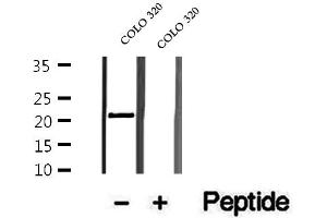 Western blot analysis of extracts of COLO 320 cells, using OBFC2A antibody.