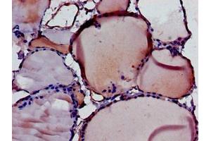 Immunohistochemistry of paraffin-embedded human thyroid tissue using ABIN7149840 at dilution of 1:100 (DIABLO Antikörper  (AA 168-236))