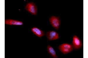 Immunofluorescence (IF) image for anti-CD33 (CD33) (AA 18-259) antibody (PE) (ABIN5567445) (CD33 Antikörper  (AA 18-259) (PE))