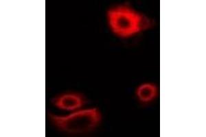 Immunofluorescent analysis of Myotilin staining in U2OS cells.
