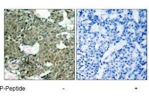 Image no. 3 for anti-Mitogen-Activated Protein Kinase Kinase 1 (MAP2K1) (pSer221), (pSer222) antibody (ABIN196888) (MEK1 Antikörper  (pSer221, pSer222))
